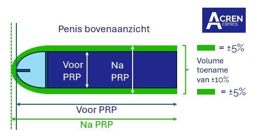 priapus shot behandeling